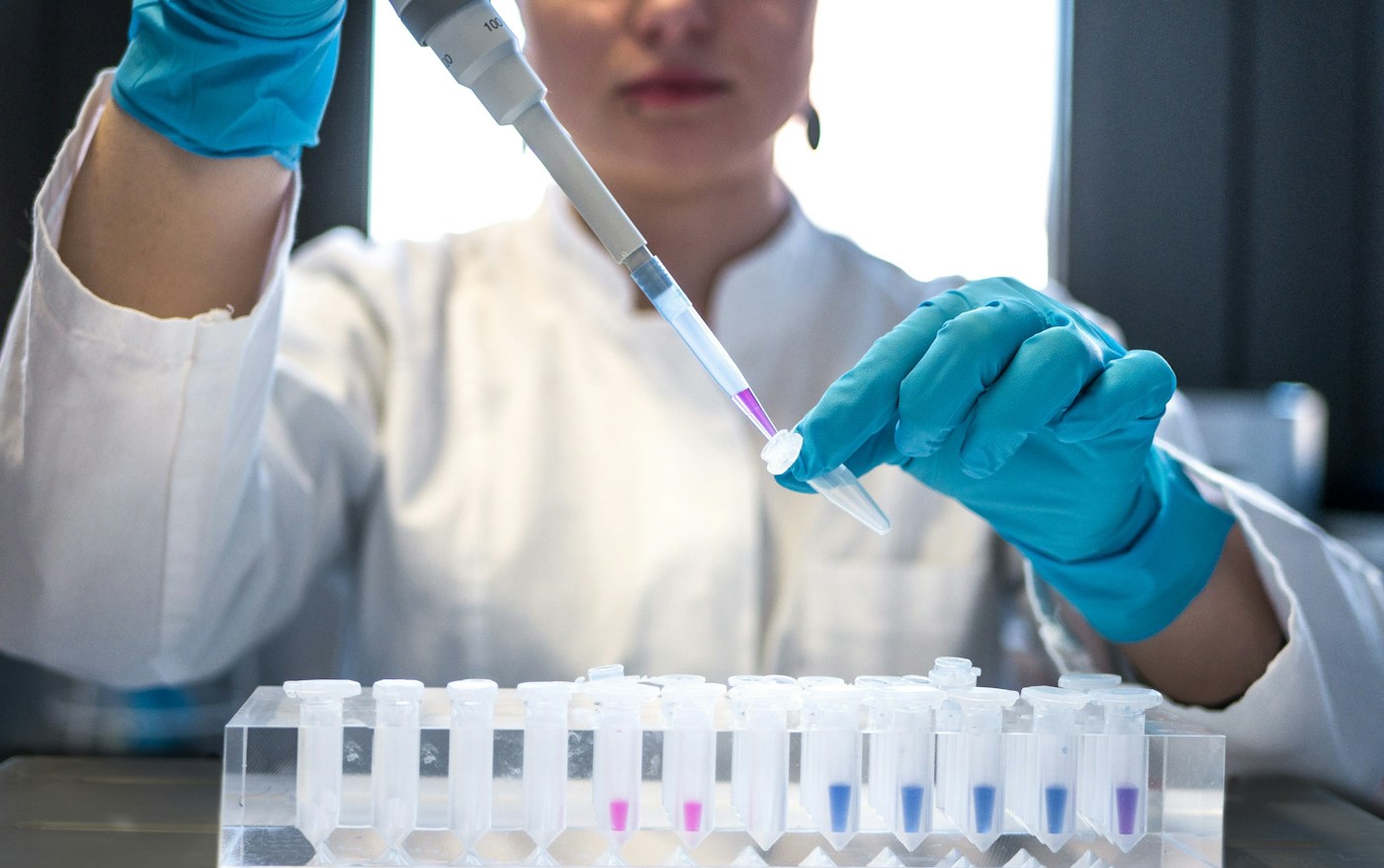 Illustrative laboratory photograph of gloved hands using a pipette with small sample tubes; not an IMULIFE employee or facility.
