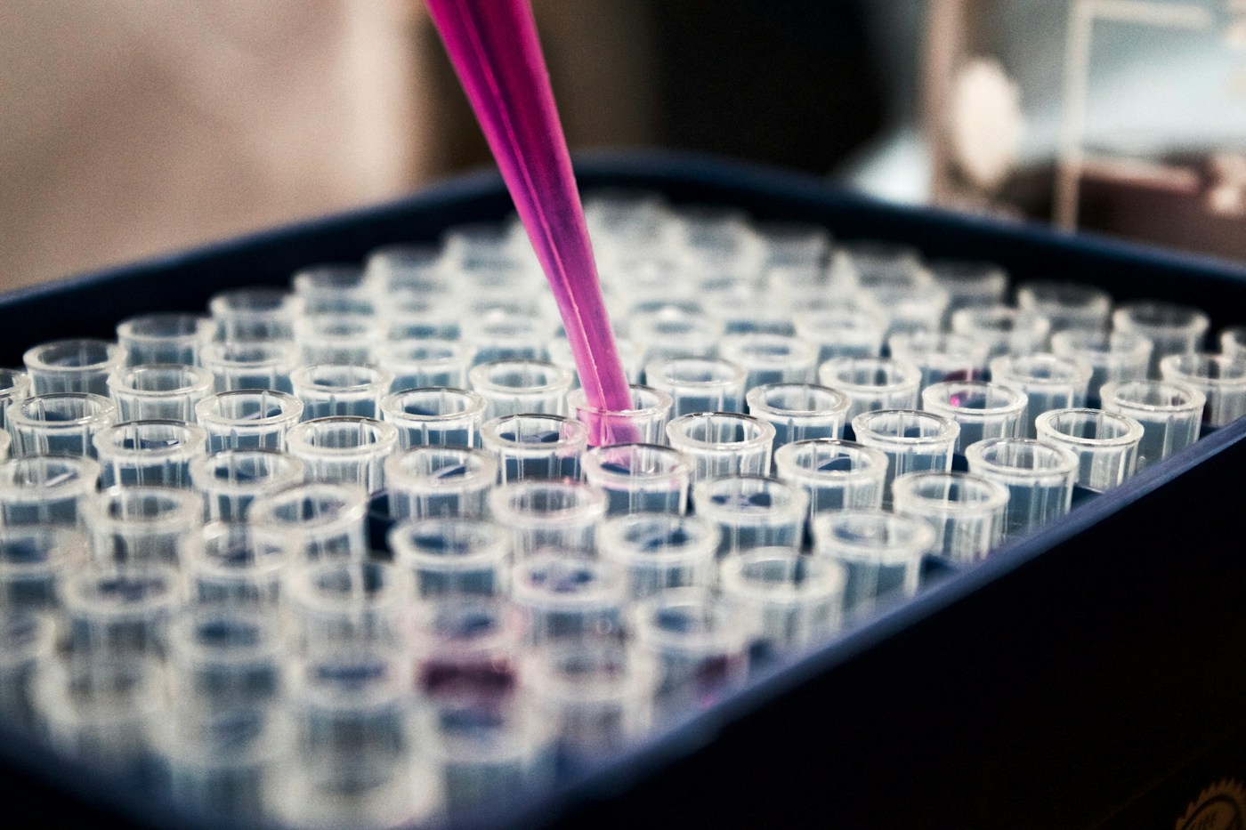 Illustrative close-up of a pipette dispensing liquid into a laboratory sample plate; not an IMULIFE test or nutritional product.